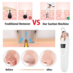 Blackhead Suction Remover Portable Pore Cleaner with LED Display and Multiple Suction Levels