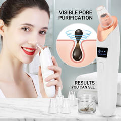 Blackhead Suction Remover Portable Pore Cleaner with LED Display and Multiple Suction Levels
